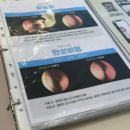 한방명의선인한의원 | 비염전문한의원 비염치료 2주 후기 두통이 사라졌어요