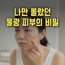 인셀덤 크림 효능 사용법 후기