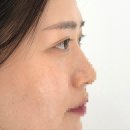 무아뷰티스튜디오운정속눈썹펌&눈썹 | 파주 다율동 속눈썹펌 맛집 ‘소메르 스튜디오’ 숱 없는 속눈썹도 또렷하게 변신후기