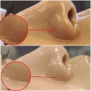 더라온메디칼 이미지