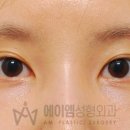 에이엠성형외과의원 이미지