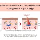 피부빛나다 네이버블로그