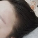 두피공방헤어라인