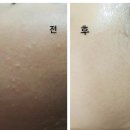 오늘은밝은피부 이미지