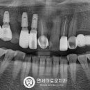 박상욱치과의원 네이버블로그