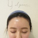 뷰티헤어라인 이미지