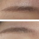 남구-127 | 광주 봉선동 눈썹반영구•눈썹 잔흔 제거 추천 ‘브로우브로우’ 후기