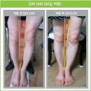 손태석 발가락운동용구 이미지