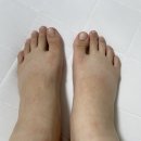 삼성신내과의원 | 대구신장내과 김현철신장내과의원 신증후군 내원후기