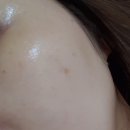 [해초필링(박피)/약초필링] 뉴 알라딘필링 솔직 한달후기! by 나주 마사지샵