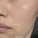 명동방앗간 아하(AHA) | 피부결 정돈 끝판왕 올리브영 아크네 패드 후기