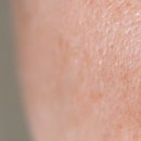 애플피부과의원 이미지