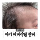 신생아 머리각질 아기 머리각질 관리법 오일 샴푸 사용 후기