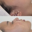 #빛나담 뷰티테라스 이미지