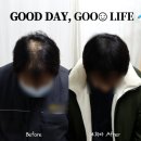 나는 소년이었다 SMP 이미지