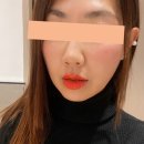 벨르몬성형외과의원 | Bellemorn- 제주성형외과 신화월드내에 위치한 벨르몬성형외과 방문 솔직 후기