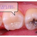 에이블치과기공소 네이버블로그