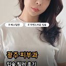 세븐일레븐 광주상무병원점 | 광주 입술필러 상무지구 피부과 입술필러1cc 전후 비교 리얼후기