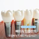 하나큐치과의원 네이버블로그