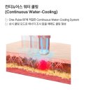 카리스의원 | 볼뉴머 효과 가격 비용 비교 만족 후기 어떤점에서?