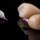 하늘치과기공소 이미지