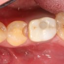 예스치과기공소 이미지