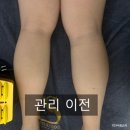 큐브 메디컬 | 송도역 옥련동 피부관리 미드림 에스떼 아로마 힐링 큐브 종아리 관리 후기