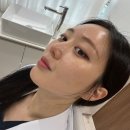 명동 리쥬란 힐러 추천 시술후기 효과 전후비교