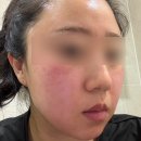 르네랩 | 창원 상남동 민감성피부 진정케어 2회차 르네아바이더랩 상남동에스테틱추천