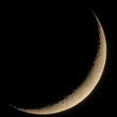 연세루아치과교정과의원 이미지