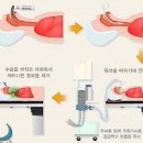 전신마취 종류, 후유증 부작용은 없을까? 이미지