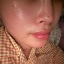 울산에스테틱 울산피부관리 리프팅효과 미쳐버린 원.더풀