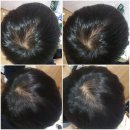 지성 | 톤28샴푸바 지성두피 각질 피지 사용후기