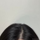 스트레스성 탈모 두피앰플 추천: 인버팀 스칼프 앤 헤어 리바이탈라이징 앰플 후기
