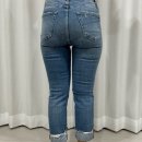 멍머리 | 대구 반월당 허벅지지방추출주사 멍 붓기 당일 후기