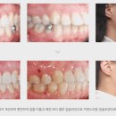 연세바른치과의원 이미지