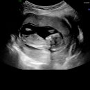 야탑로65번길 이미지