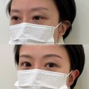 온나뷰티랩 | “온나뷰티랩 건대 눈썹문신 헤어스트록 시술 후기 (만족 추천)”