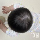 아이사랑두헬멧 대전센터 | 아이사랑두 두상교정헬멧 7개월간 착용 후기(세종,대전,부산,대구,전주 센터 추천인 가능)