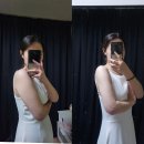 팔뚝살주사가격 예비신부 드레스라인관리 2개월 후기