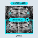 장산역치과 사랑니발치 잇몸부음 약국약 후기