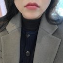 [뷰티] 입술필러 맛집 내돈내산 필러 시술 주의사항 &lt;바이미성형외과&gt;