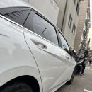 안산 외형복원 후기 찐 리뷰 (최고로 외형복원) 내돈내산