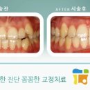 클리어치과기공소 이미지