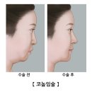 코 이미지