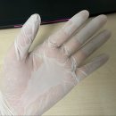 한포진 주부습진 치료 후기 / 피부과 추천