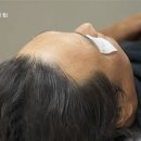 백반증 치료 받는 배우 구성환.gif 이미지