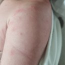 호소아청소년과의원 이미지