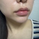 신사역 입술필러 대대대대만족 찐 후기 낋여옴