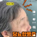 지나치기 쉬운 뇌질환 관련 전조증세 이미지